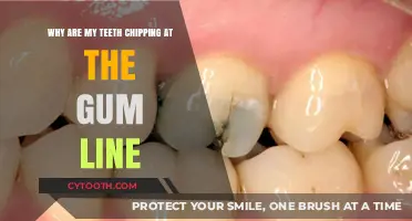 Why Are My Teeth Chipping at the Gum Line? Causes & Solutions