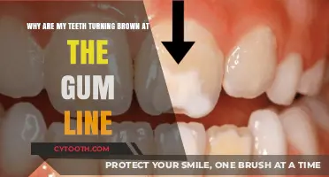 Brown Teeth at Gum Line: Causes and Solutions Explained