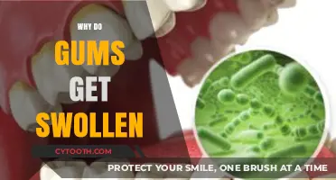 Understanding Swollen Gums: Causes, Symptoms, and Effective Remedies Explained