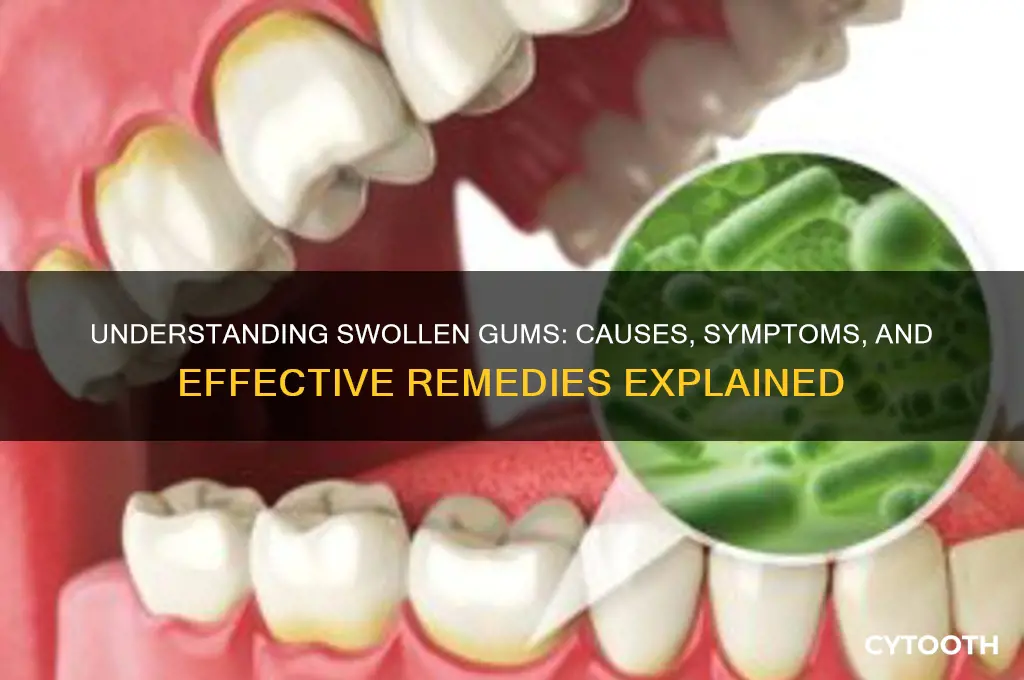 why do gums get swollen