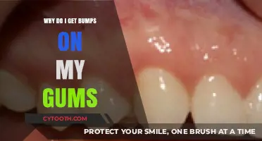 Bumps on Gums: Causes, Concerns, and Effective Treatment Options