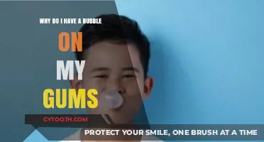Gum Bubble Mystery: Causes, Concerns, and Treatment Options Explained