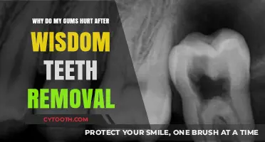 Post-Wisdom Teeth Removal Gum Pain: Causes and Relief Explained