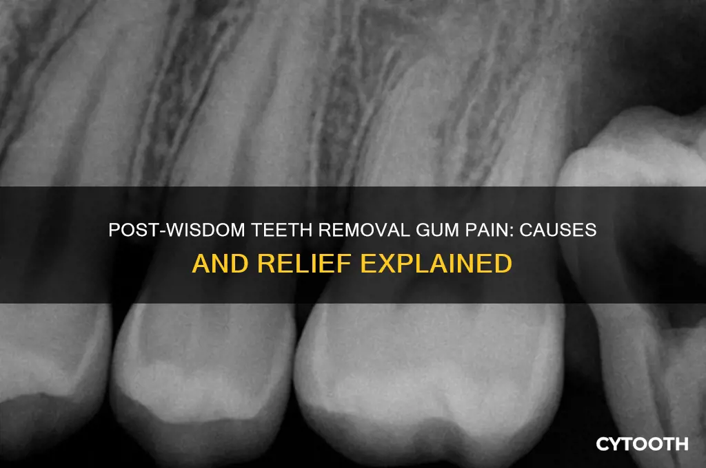 why do my gums hurt after wisdom teeth removal