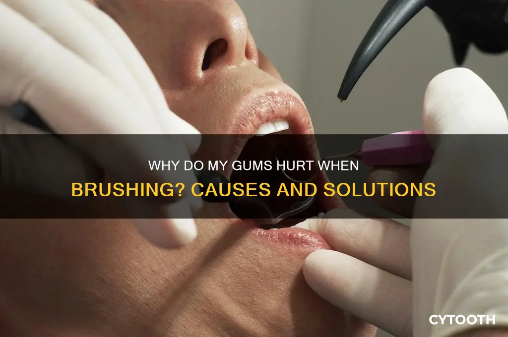 why does my gums hurt when i brush my teeth