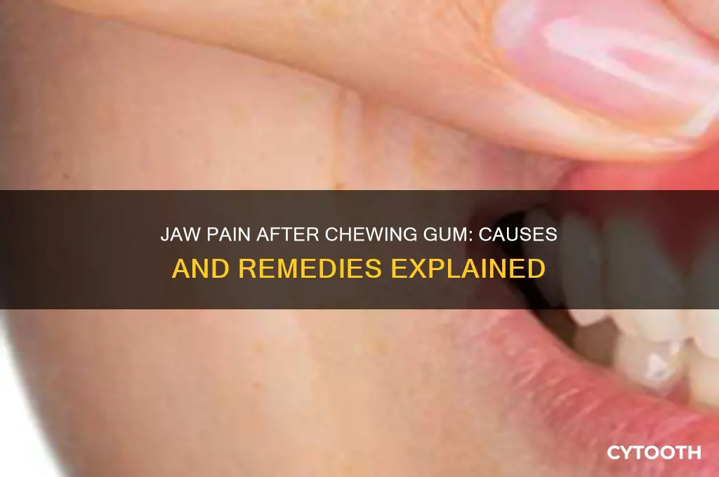 why does my jaw hurt after chewing gum