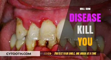 Can Gum Disease Be Fatal? Uncovering the Serious Health Risks