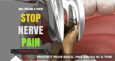 Can Tooth Extraction Relieve Nerve Pain? Exploring the Connection
