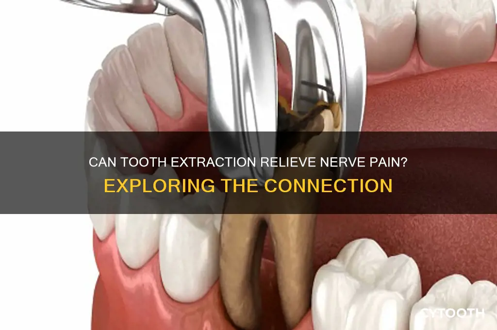 will pulling a tooth stop nerve pain